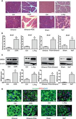 BRD4 Inhibition Protects Against Acute Pancreatitis Through Restoring Impaired Autophagic Flux